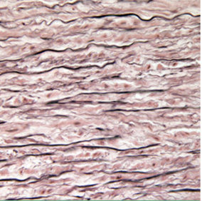 <p>Tissue?</p>