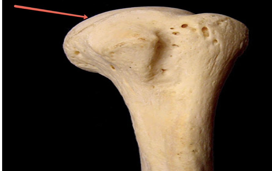 <p><span><strong>Identify the bone marking indicated by the pointer.</strong></span></p>