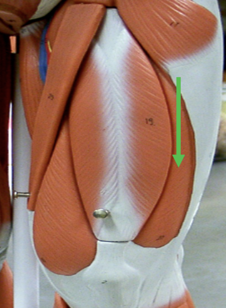 <p>Identify the muscle indicated by the pointer.</p>