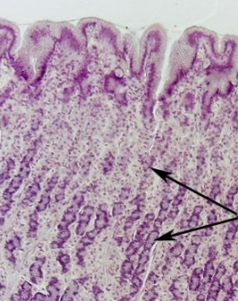 <p>what are arrows pointing to (stomach)</p>