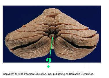 <p>Identify the indicated lobe of the cerebellum</p>