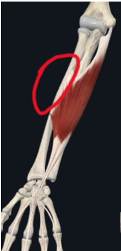 term image