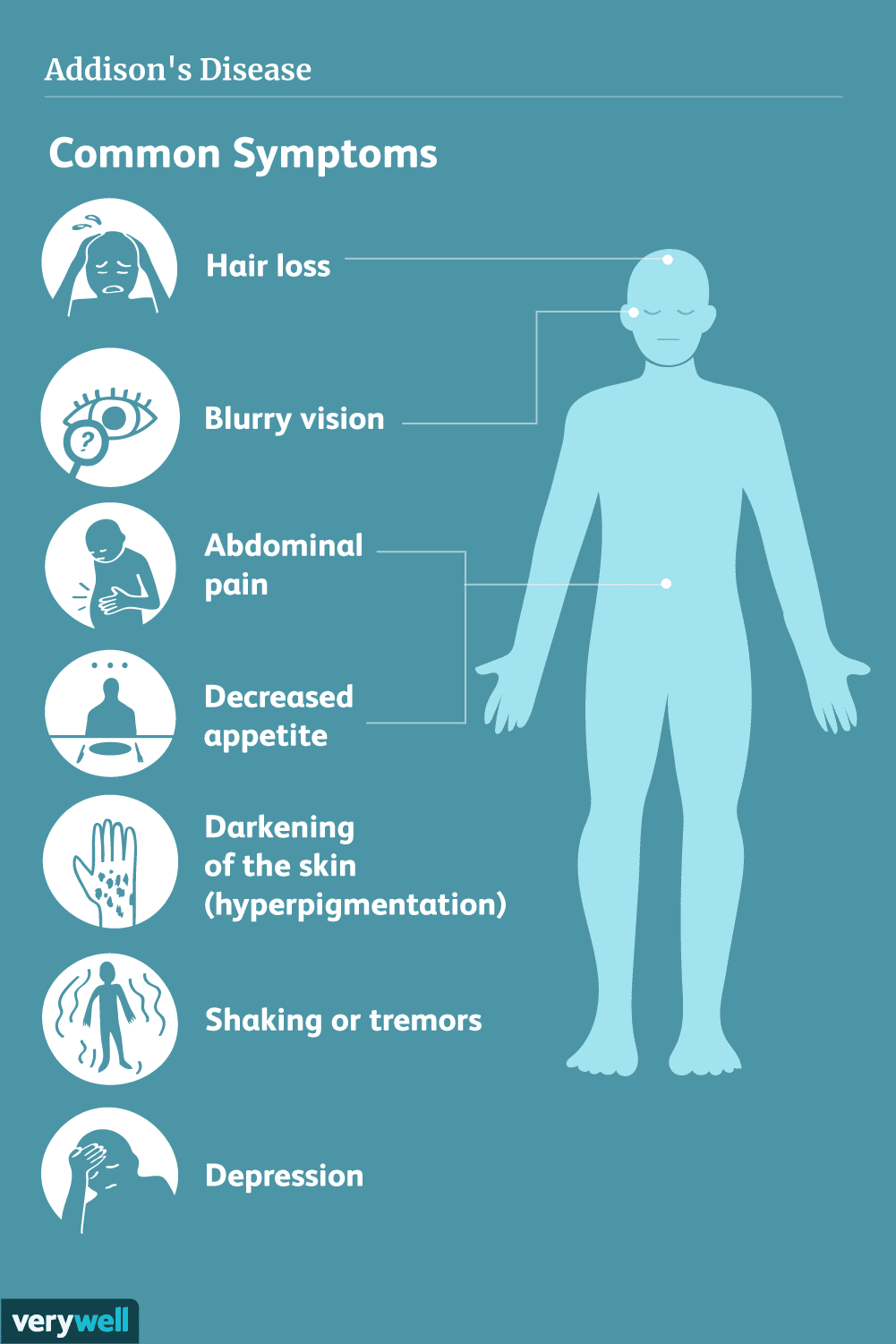 <p>A condition in which the <strong>adrenal glands do not produce enough hormones</strong>, especially <strong>cortisol and aldosterone</strong>.</p>