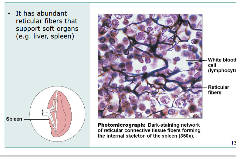 <p>support soft organs with abundant reticular fibers</p><p>internal skeleton of spleen</p>