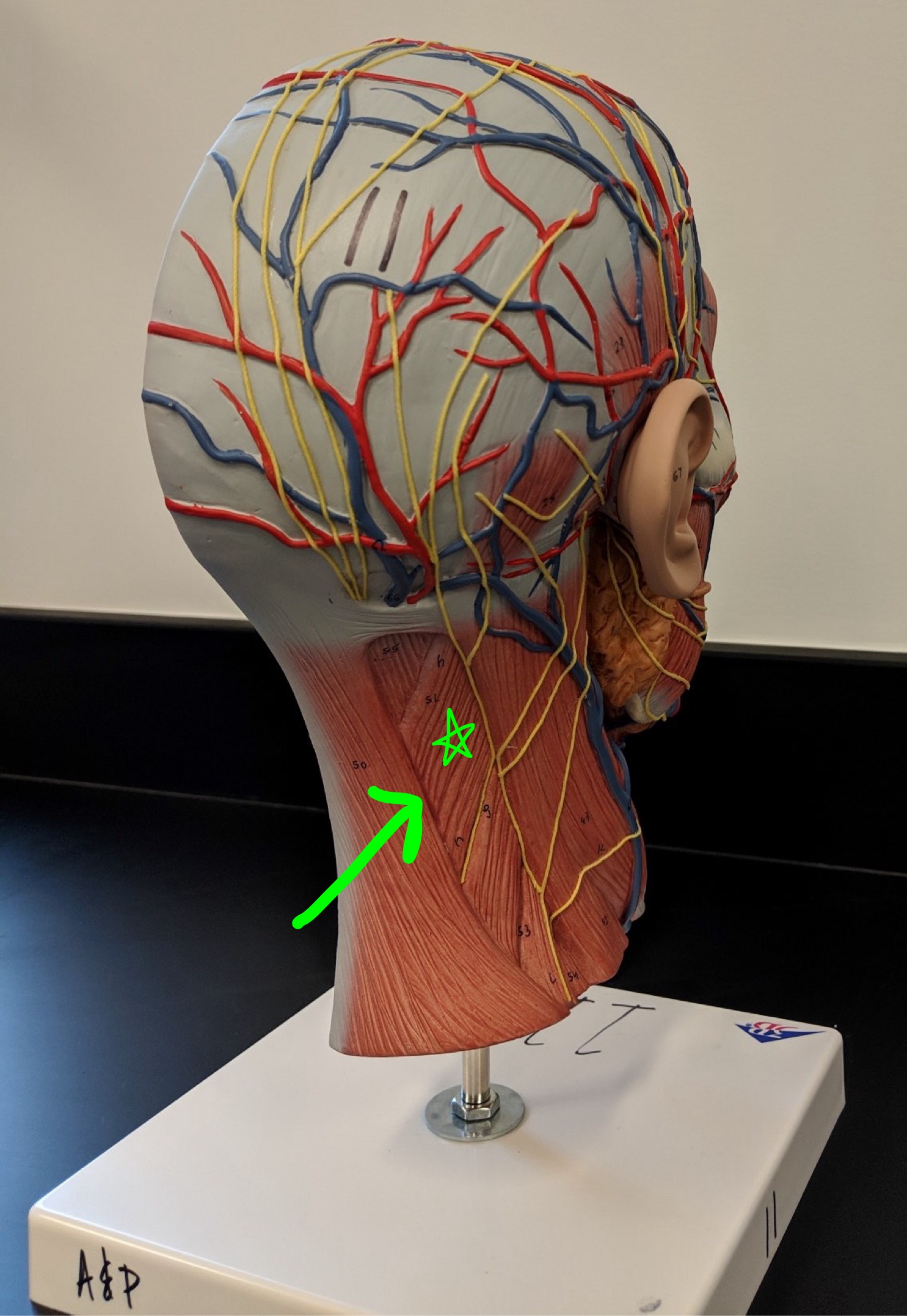 <p>Name the muscle.</p>