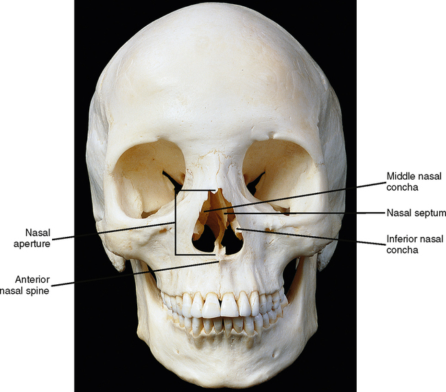 <p>pear-shaped bony opening in the juman skull that forms the anterior entrance to the nasal cavity </p>