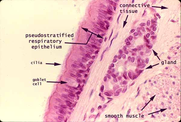 <p><strong>ciliated pseudostratified columnar </strong>epithelium lining</p>