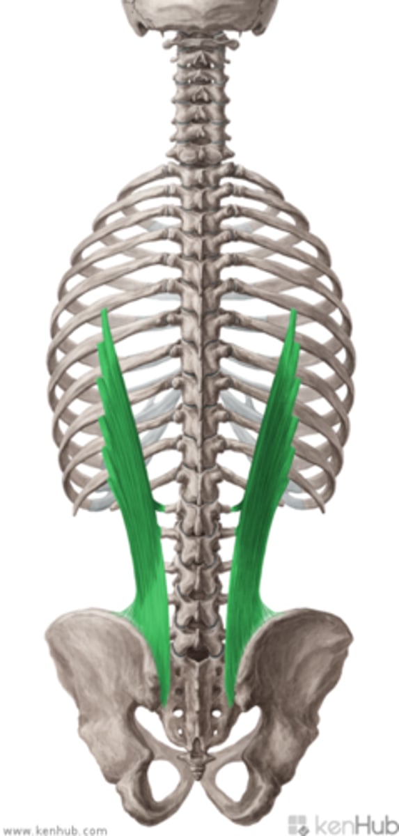 <p>sacrum</p><p>spinous processes lumbar vertebrae</p><p>spinous process T11-T12</p><p>supraspinous ligament T11-T12</p><p>iliac crest</p>
