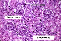 <p>histologically classify the epithelium of these ones and name them anatomically</p>