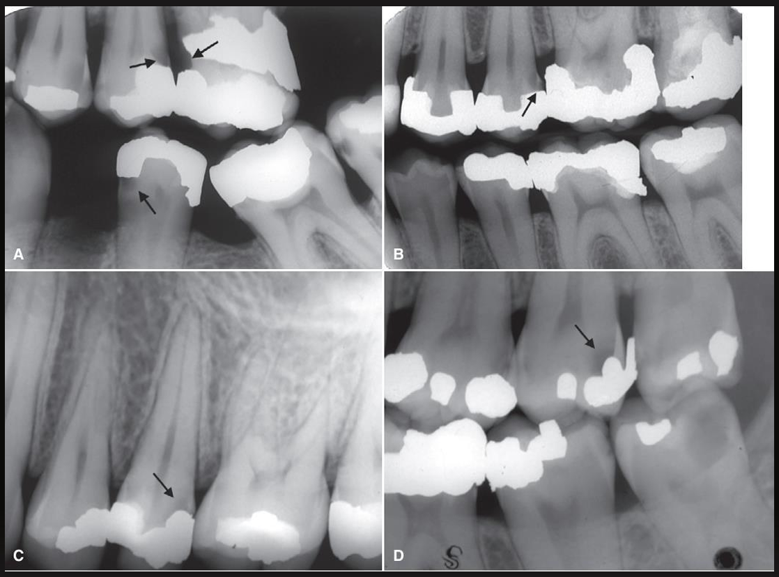 <p>what do these images have?</p>