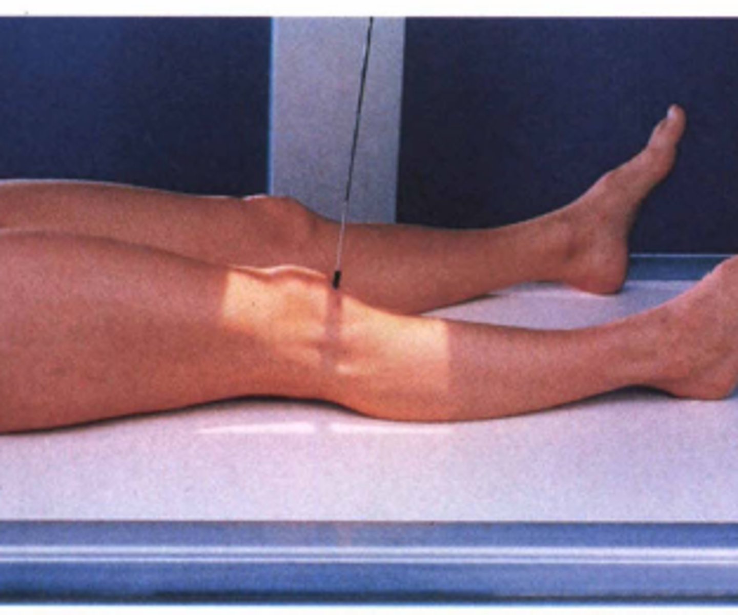 <p>S - on lap</p><p>T - 5 mAs @ 60 kVp</p><p>A - none (if large person= 5 degrees cephalic)</p><p>M - correct leg, on cassette</p><p>P - Supine, CR 1/2" below apex</p><p>S - 40"</p><p>B - hold</p><p>C - 10 x 12, L</p>