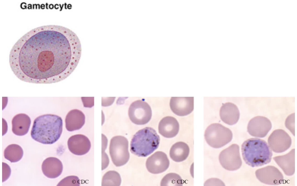 <ul><li><p><span style="background-color: transparent;">Plasmodium vivax gametocyte consists of a large pink to purple chromatin mass, which is surrounded by a colorless pale halo.</span></p></li><li><p><span style="background-color: transparent;">Evenly distributed cytoplasmic brown pigments is usually visible.</span></p></li></ul><p></p>
