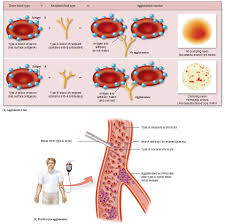 <p>What may happen if incompatible blood is given?</p>