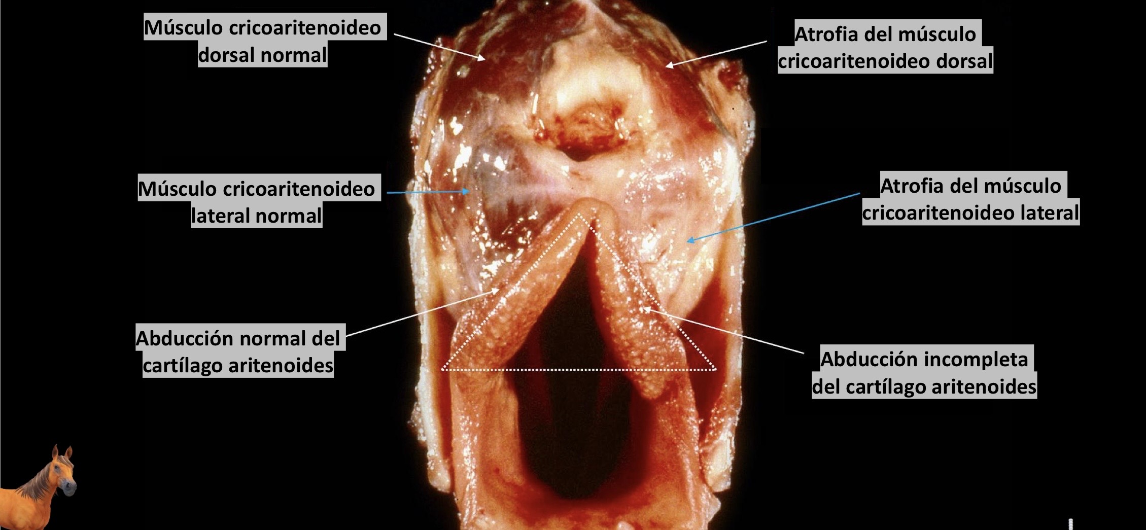 <p>Patogenia </p>