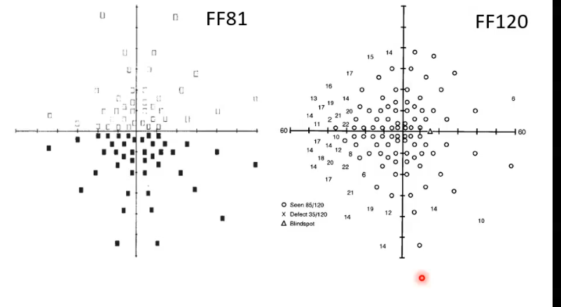 <p>eg 60 degrees from fixation</p><p>FF: full field </p><p>begins with suprathreshold then moves out as can be time consuming</p>