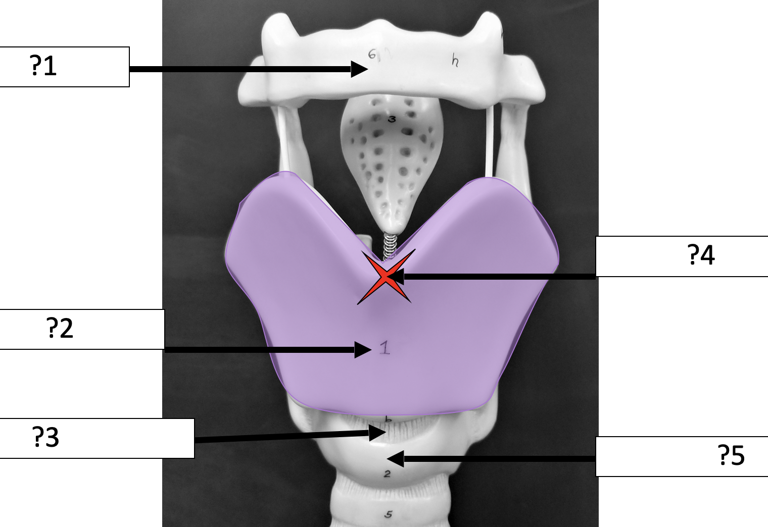 <p>1 Name the bone?</p>