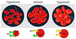 <p><span>cells whose outer membranes have been broken down or destroyed (oncolysis) to release internal materials like protein, DNA, or RNA</span></p>