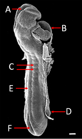 <ol><li><p>Label A, B, C, D, E and F</p></li><li><p>What view is this?</p></li></ol><p></p>