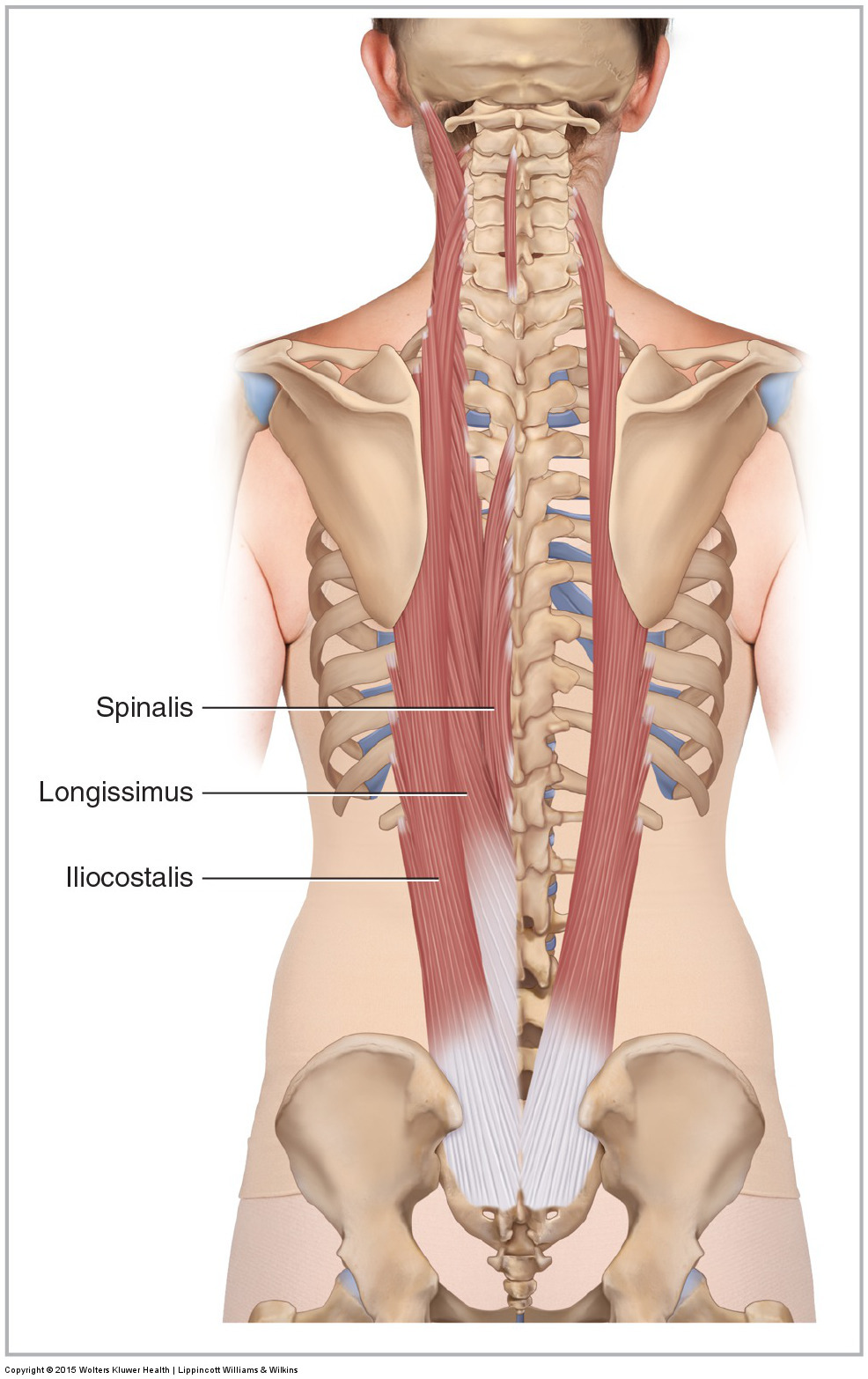 <p>Spinalis</p><p>Longissimus </p><p>Iliocostalis </p>