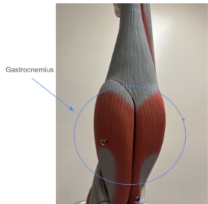 <p><span style="background-color: transparent; font-family: "Times New Roman", serif;">Gastrocnemius</span></p>