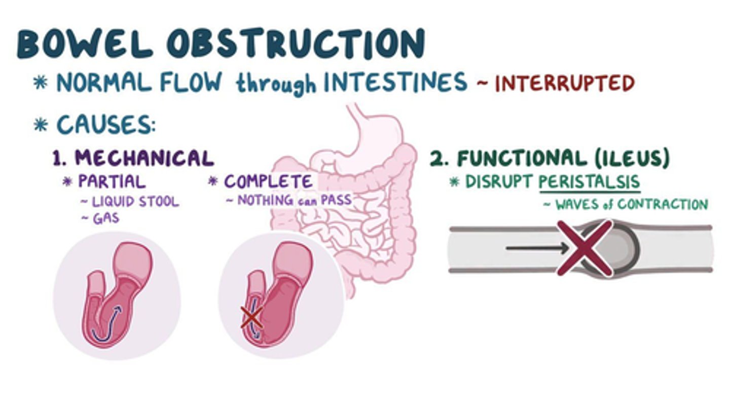 <p>C) An obstruction caused by a lack of normal intestinal motility, often due to conditions like paralytic ileus</p><p>(example- nerve function not returning after surgery)</p>