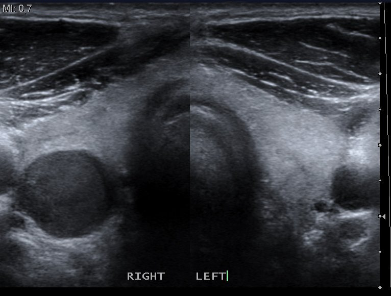 <p>What is this image demonstrating?</p>