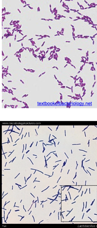 <p>what bacterial genus has the following characteristics:</p><ul><li><p>gram stain: <strong>medium-long GPR in chains, but variable</strong> </p></li><li><p>colony on BAP: looks <strong>alpha hemolytic</strong> (can resemble alpha-strep) </p></li><li><p>most are microaerophilic, but some are facultative anaerobes or anaerobic (<strong>can be groups with anaerobes</strong>)</p></li></ul><p></p>