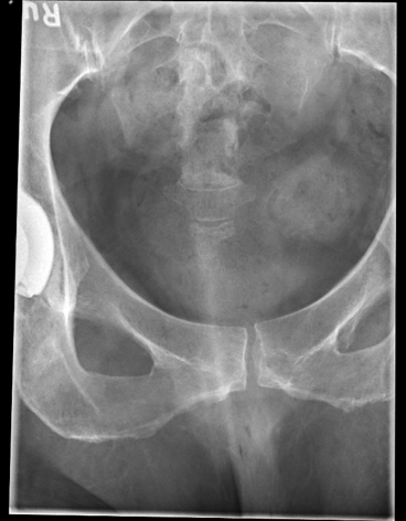 <p>critique this coccyx AP axial</p>