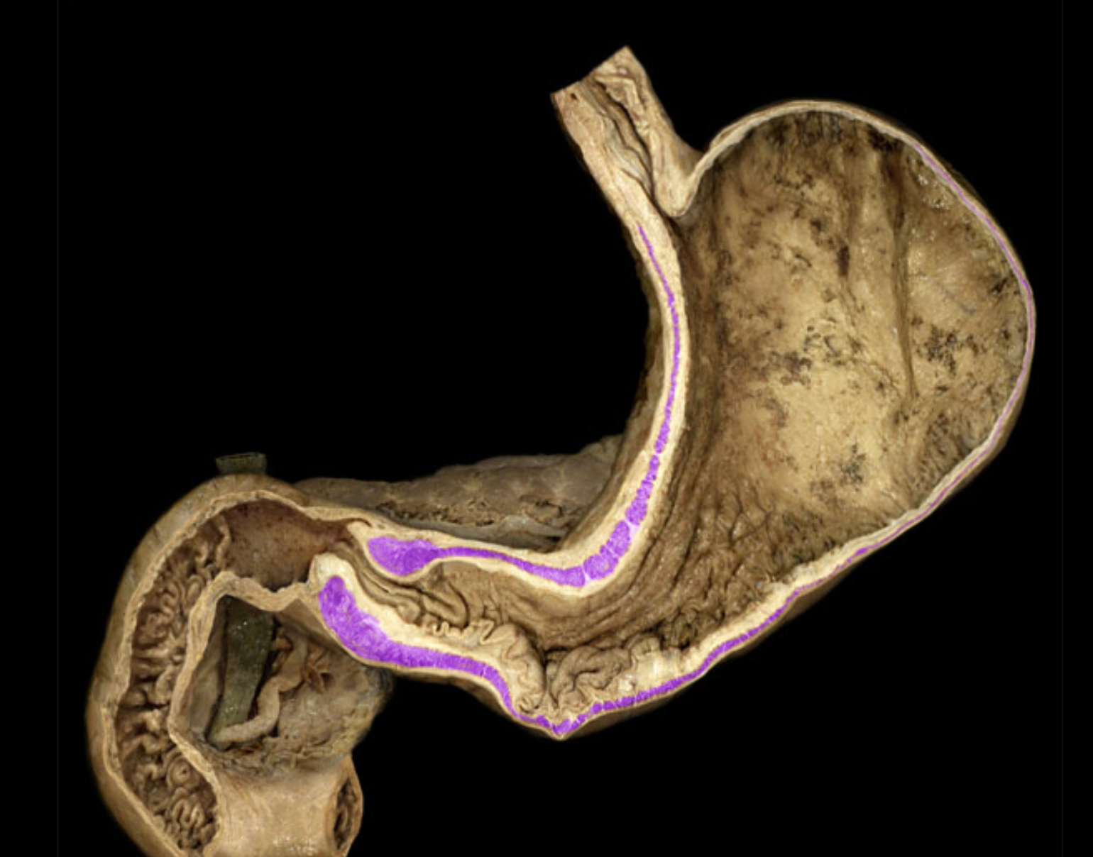 term image
