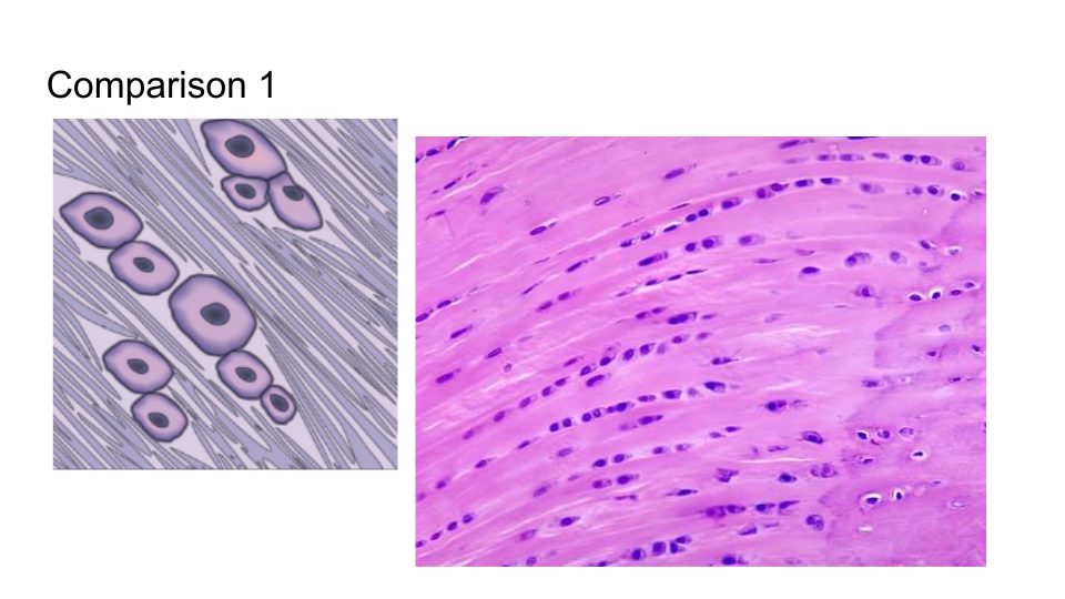 <p><strong>Fibrocartilage</strong></p>