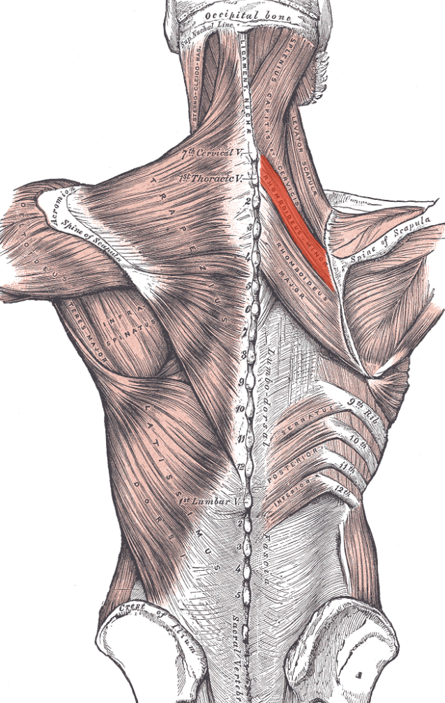 term image