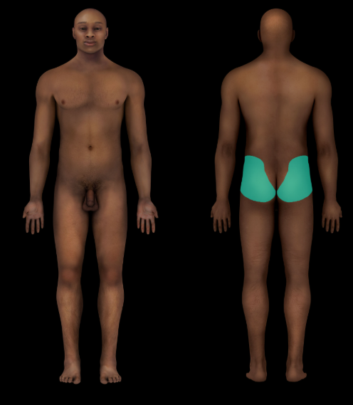 term image