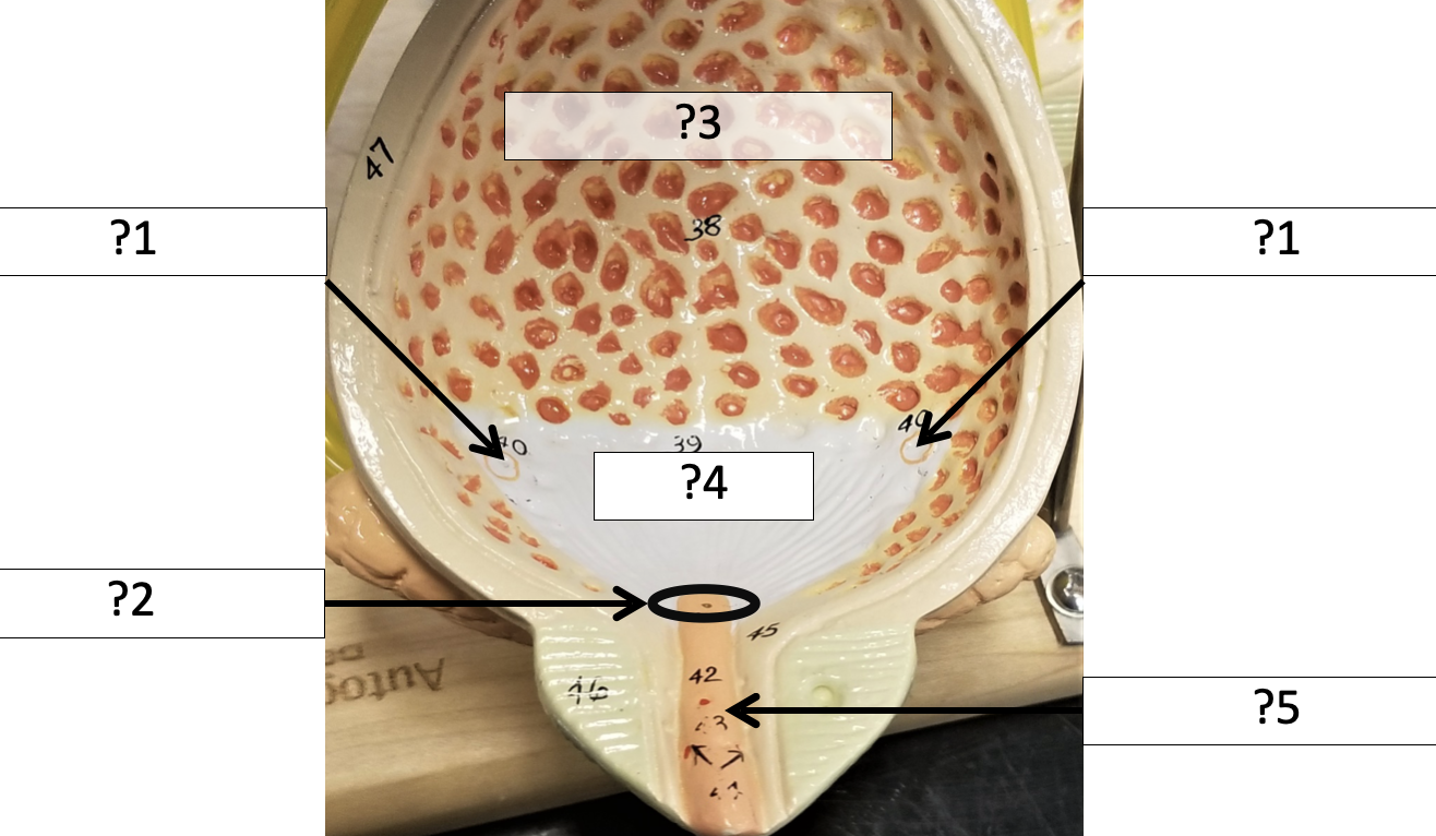 <p>3 Name the muscle?</p>