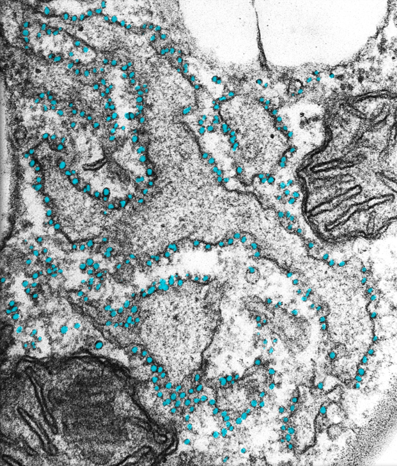 <p>Ribosome</p>