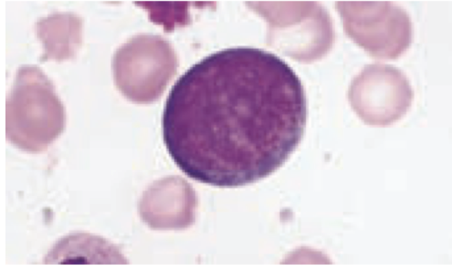 <p>first step in erythrocyte formation (earliest morphologically distinguishable erythroid precursor)</p><ul><li><p>diameter: 20-25 micrometers</p></li></ul><ul><li><p>nucleus takes up 80% of the cell (high nuclear to cytoplasm ratio); round</p><ul><li><p>stains bluish-purple (basophilic due to RNA)</p></li><li><p>lacy chromatin</p></li><li><p>only 1 to 2 nucleoli present</p></li></ul></li><li><p>golgi complex may be visible</p></li><li><p>chromatin is distinct and spread out</p></li><li><p>ready to divide at 12 hrs</p></li></ul><p></p>