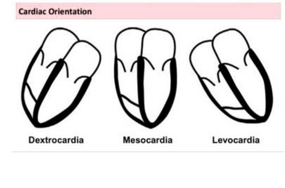 <p>Levoposition • Dextroposition • mesoposition</p>