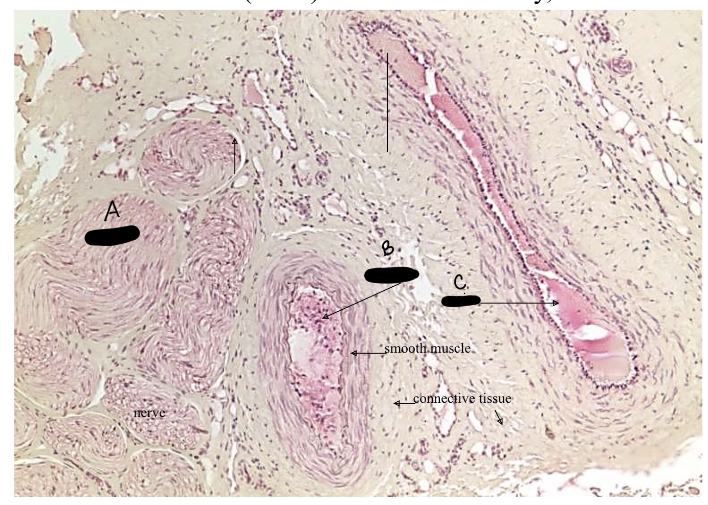 <p>Label the vein, artery, and nerve</p>