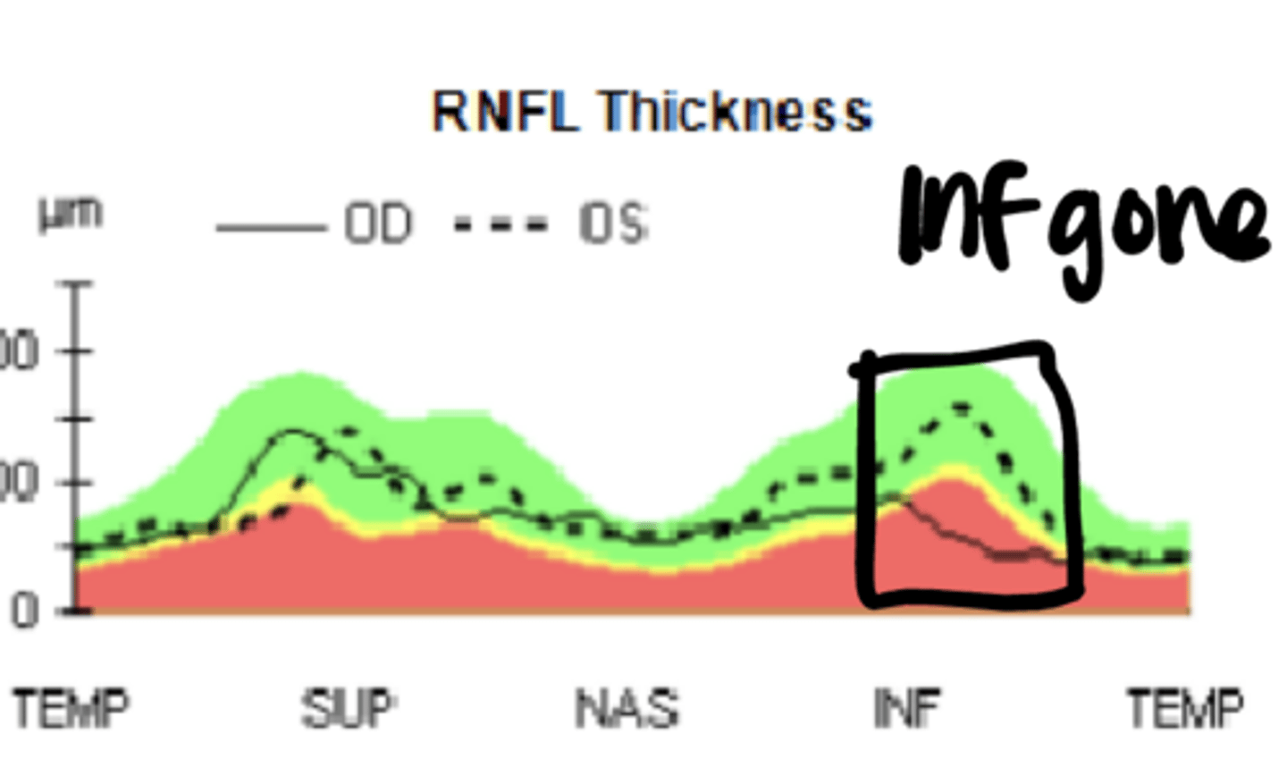 <p>TSNIT Curve for IT Drance Hemorrhage</p>