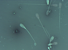 <p>Reported as normal in other species</p><p>Retrospective study found sperm with an abaxial tail attachment fertilize ova at a normal rate-DOES NOT AFFECT FERTILITY</p>