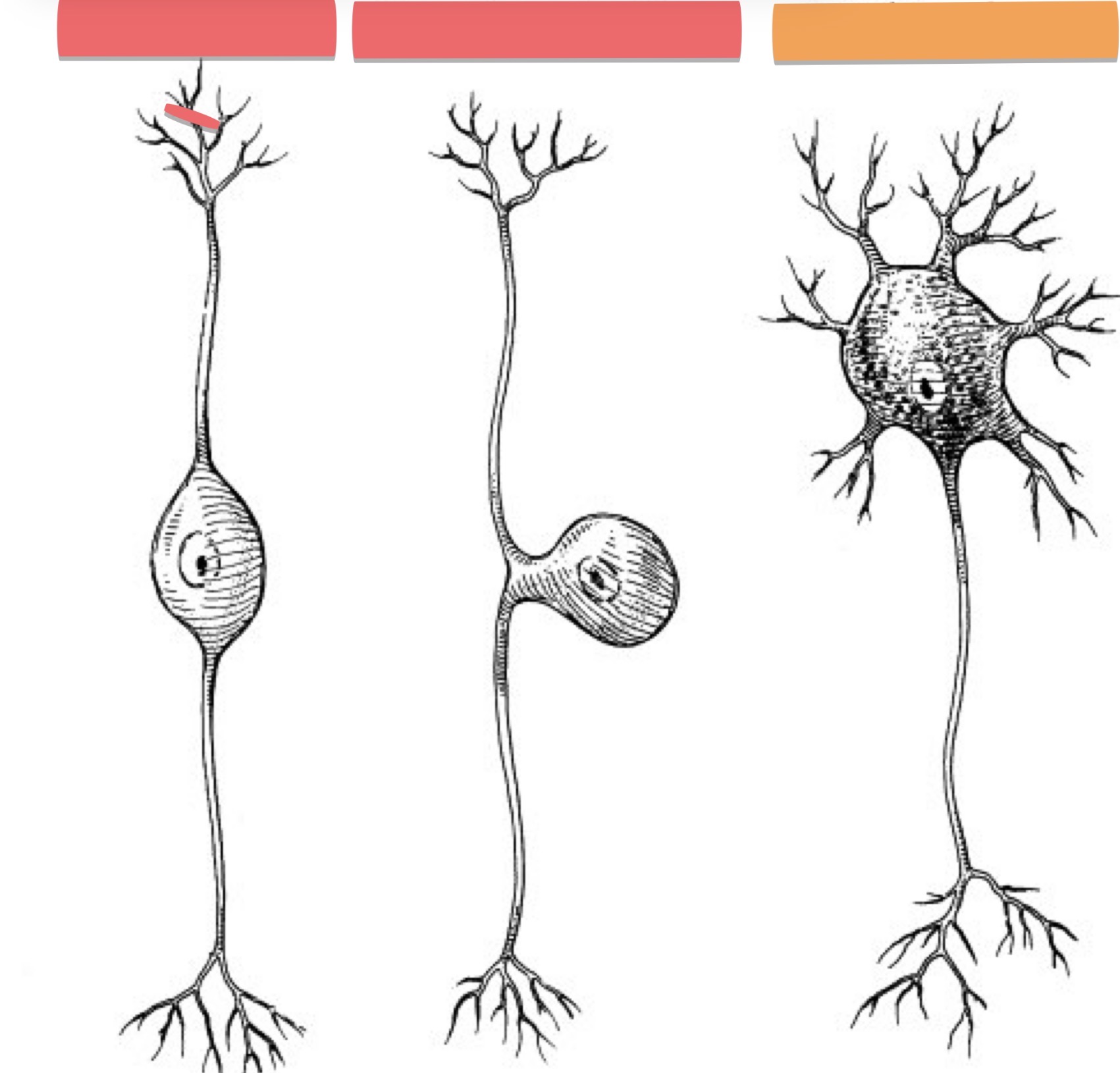 <p>What Neuron is this?</p>