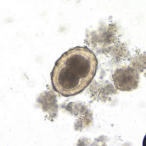<p>What egg is this?</p>