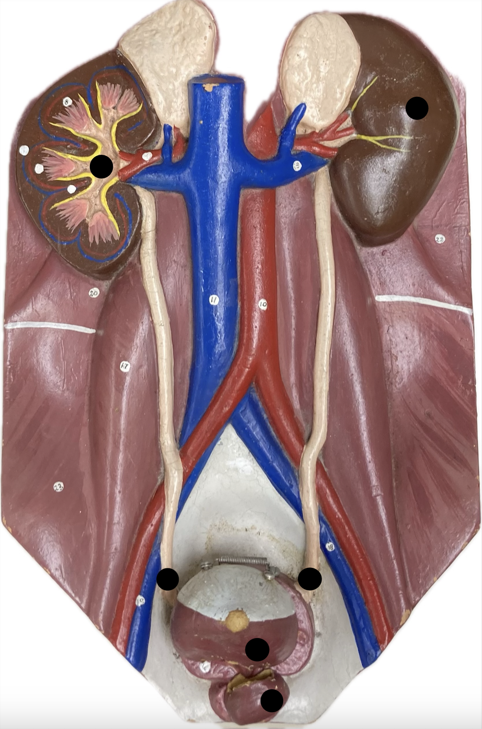 <p><span>Anatomy of the Urinary System</span></p>