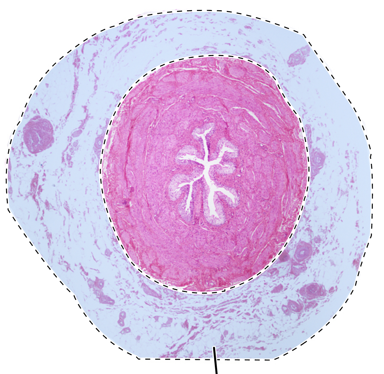 term image