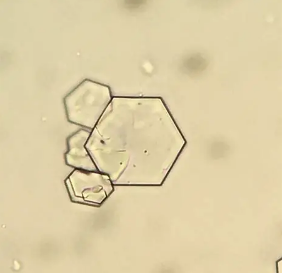 <p>Are cystine crystals pathogenic or non-pathogenic?</p>