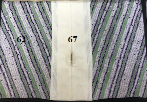 <p>What do these fibers represent?</p>