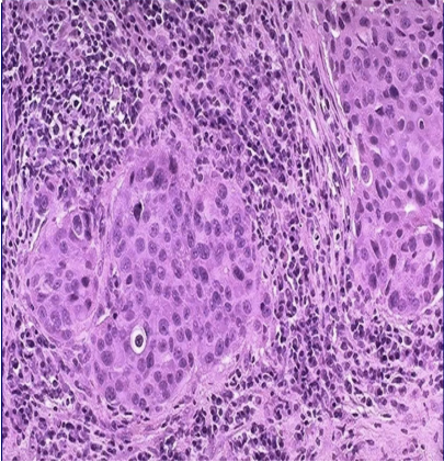 <p>What pathology?</p>