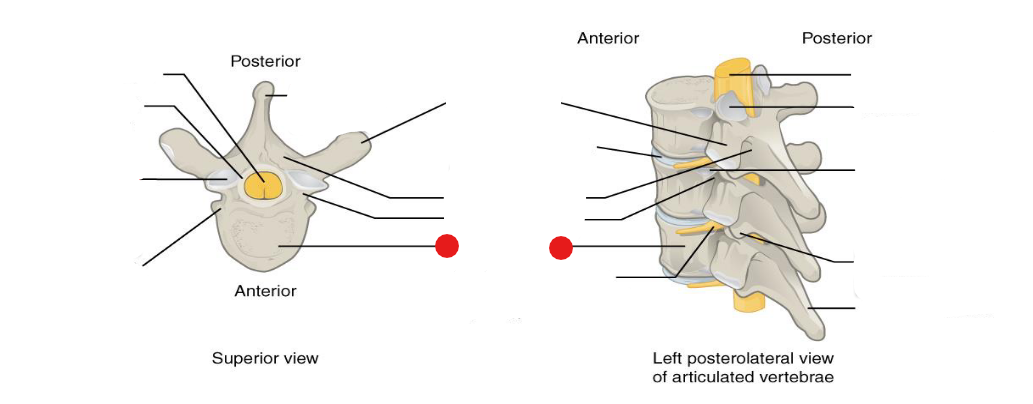 <p>Identify the structure pinned</p>