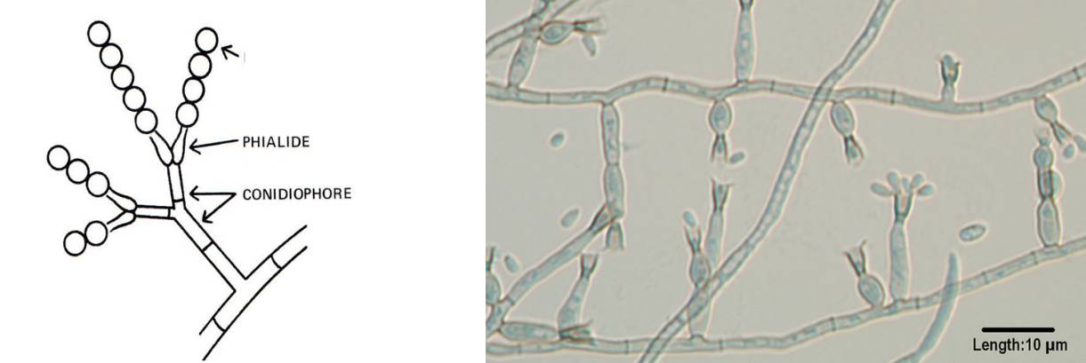 <p>bottle shaped conidiogenous cells. apices produce conidia in masses or in chains. some apices have collarettes</p>