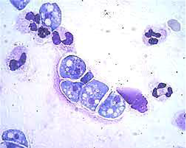 <p><span>CSF<br>Wright Stain</span></p>