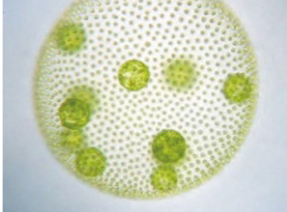 <p>What is this?<br><br>A) Spirogyra<br>B) Volvox<br>C) Euglena<br>D) Anabaena</p>